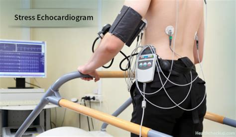 blood pressure drop stress test|echocardiogram stress test results.